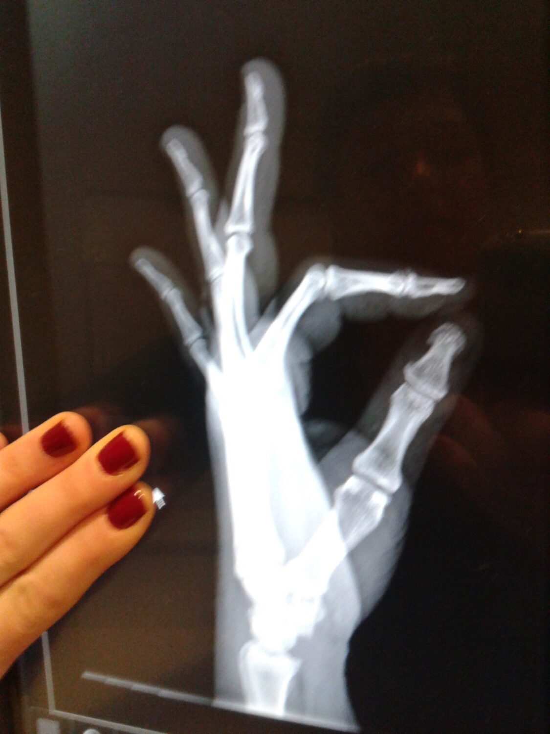 Myoskeletal Alignment Therapy in MN SHIFT Fitness & Massage